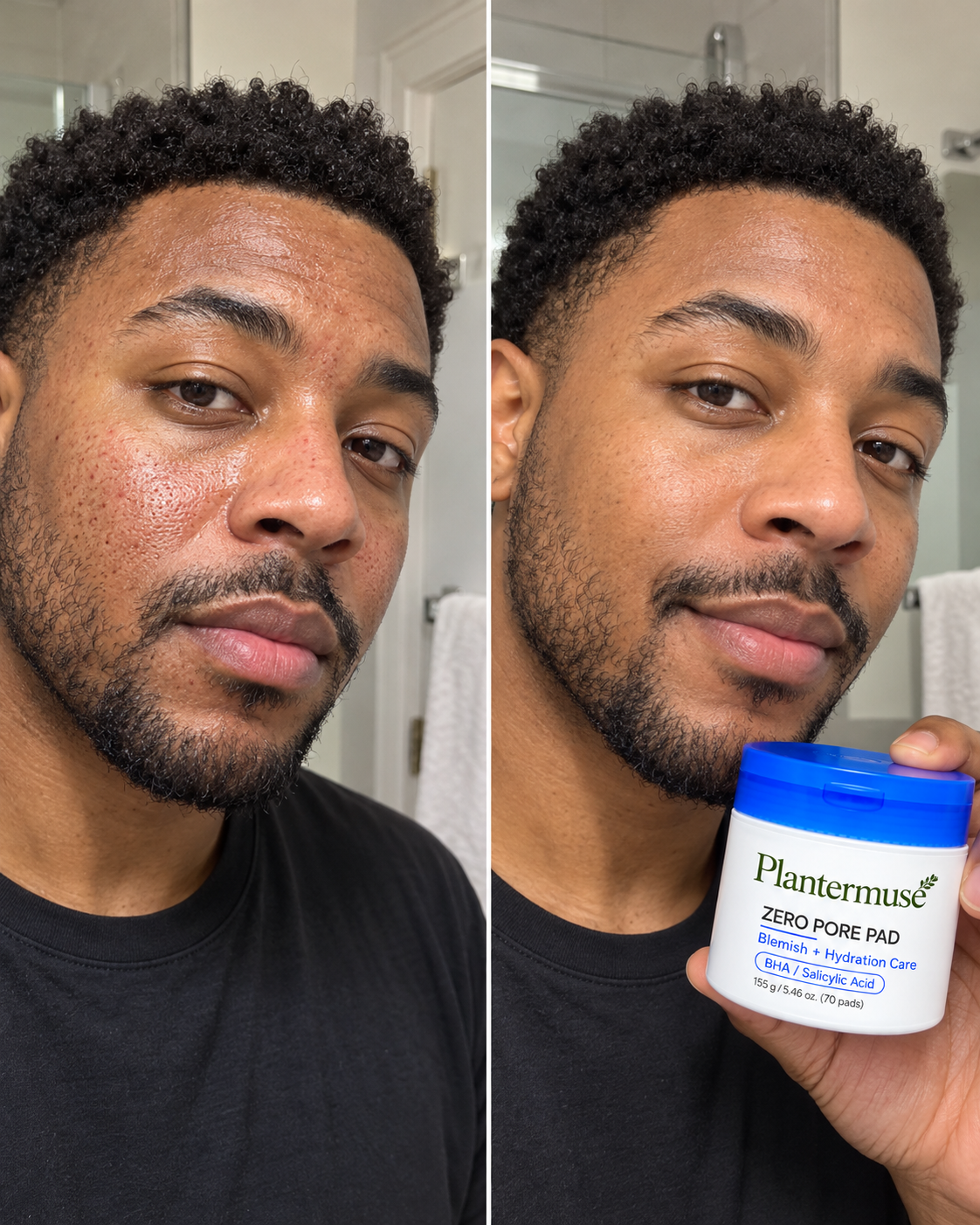 Zero Pore Pad before and after result 6