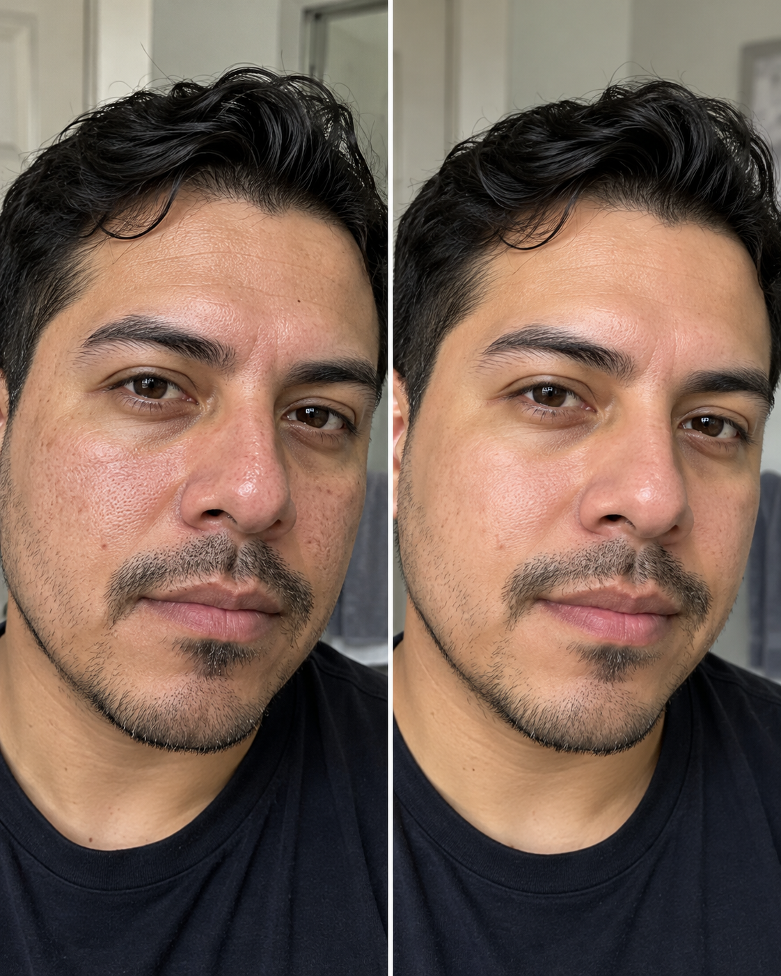 Zero Pore Pad before and after result 7