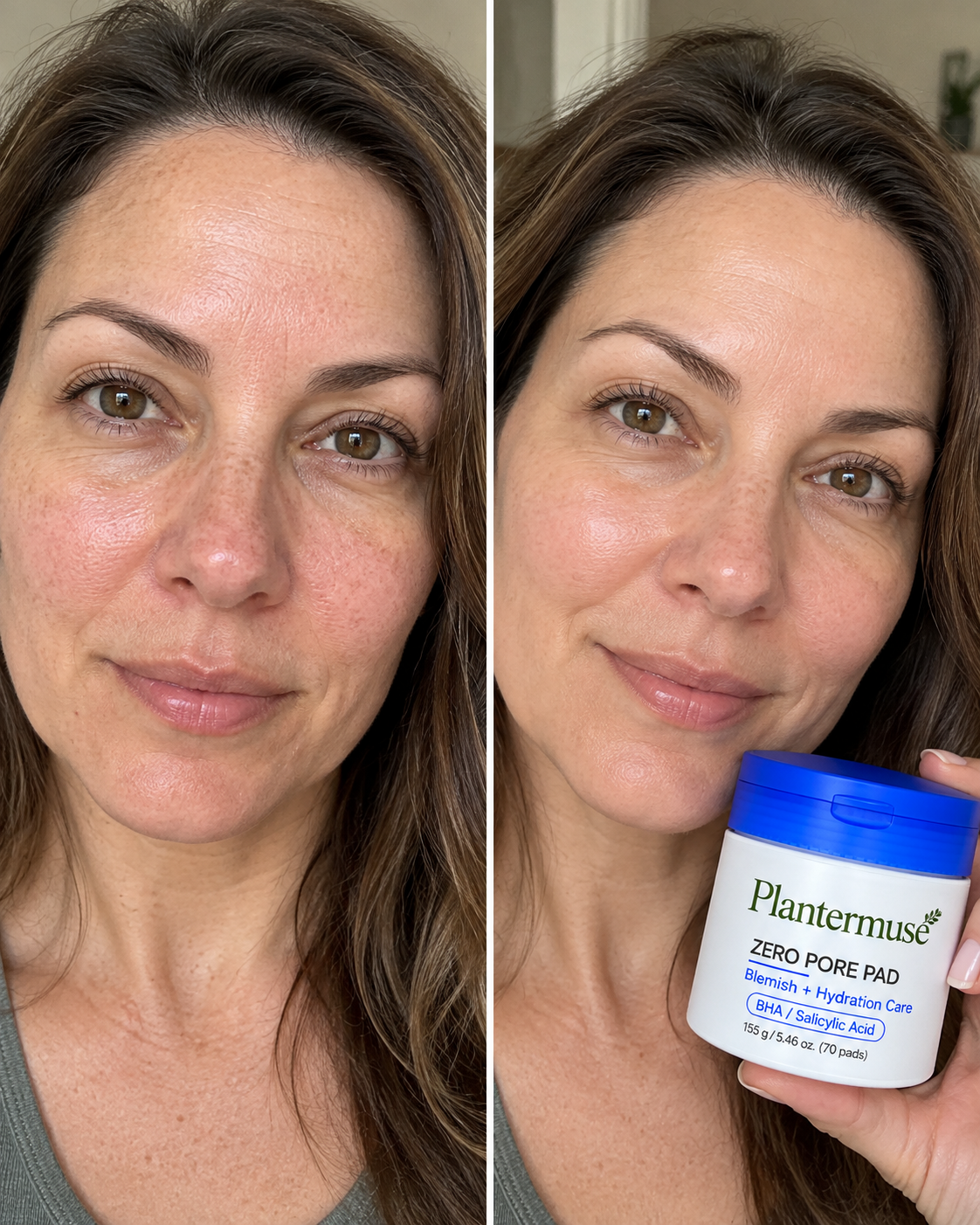 Zero Pore Pad before and after result 8