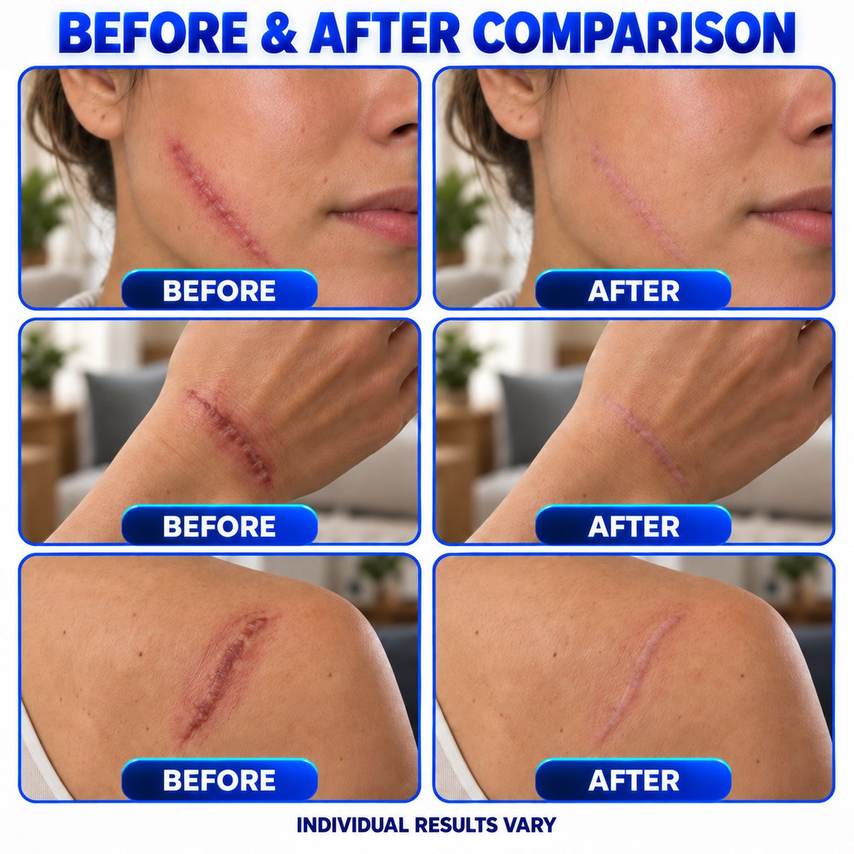 Plantermuse® Scar Care Gel