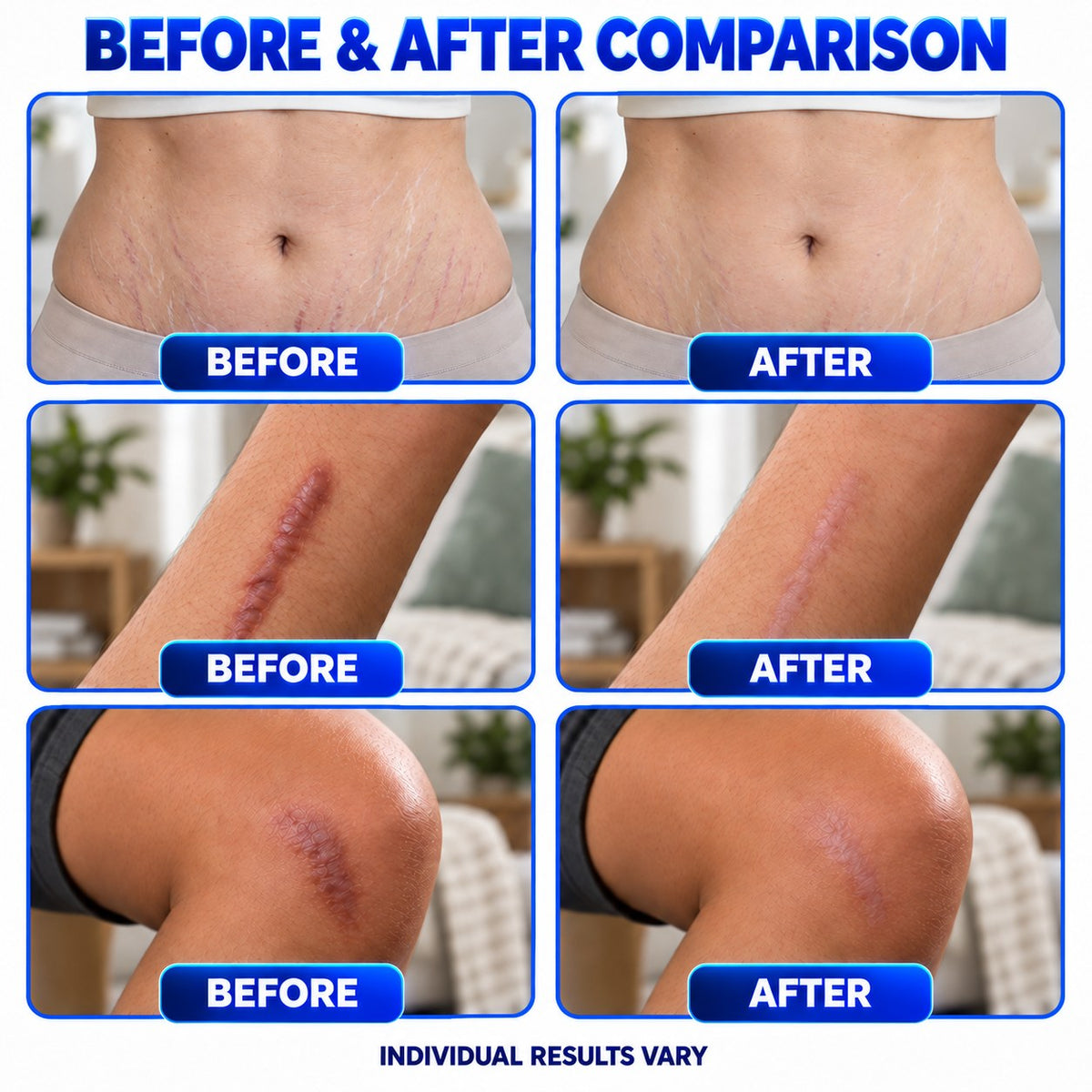 Plantermuse® Scar Care Gel