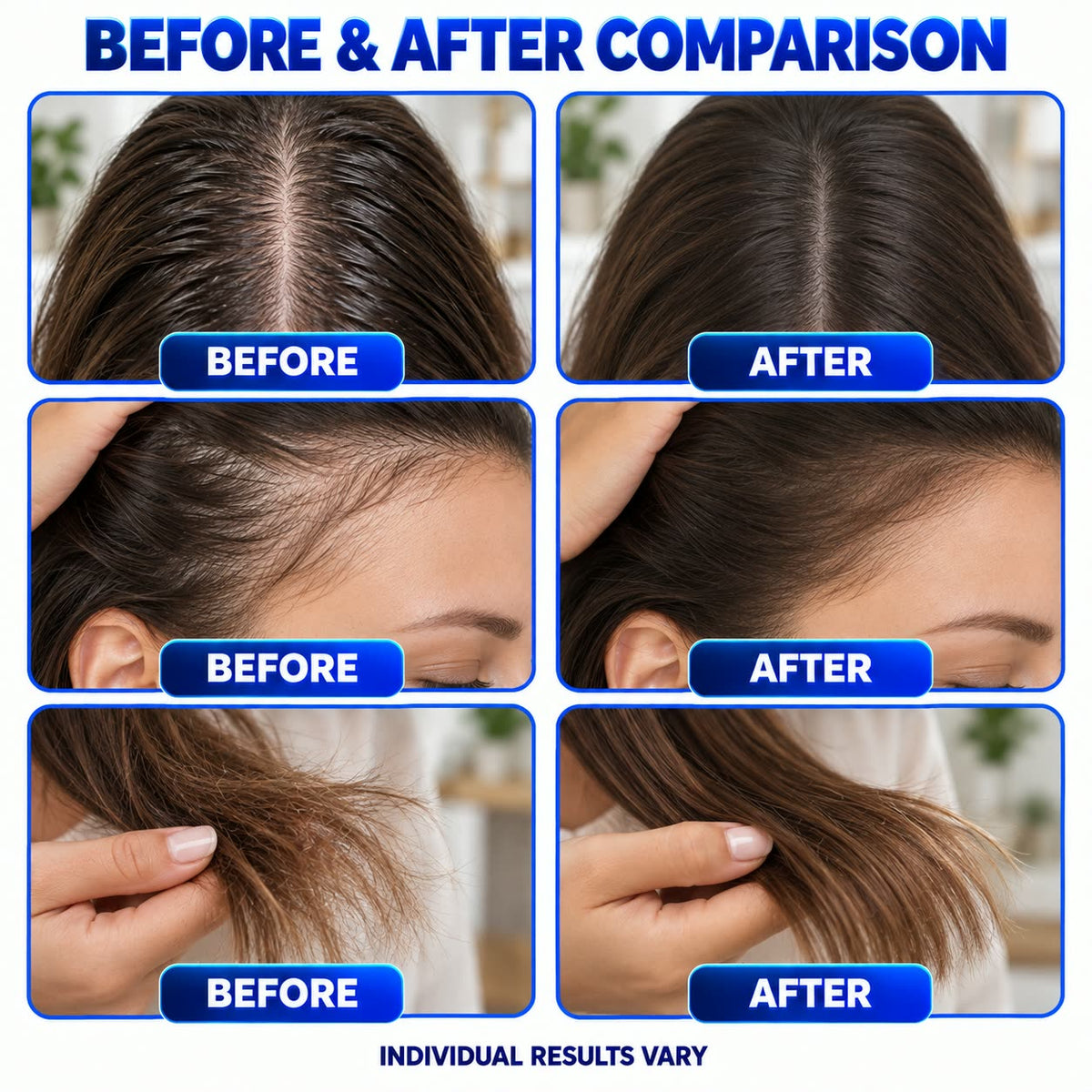 Plantermuse®Refreshing Rosemary & Rice Water Hair & Scalp Spray