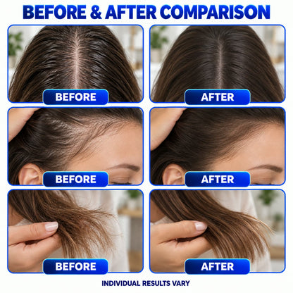 Plantermuse®Refreshing Rosemary & Rice Water Hair & Scalp Spray
