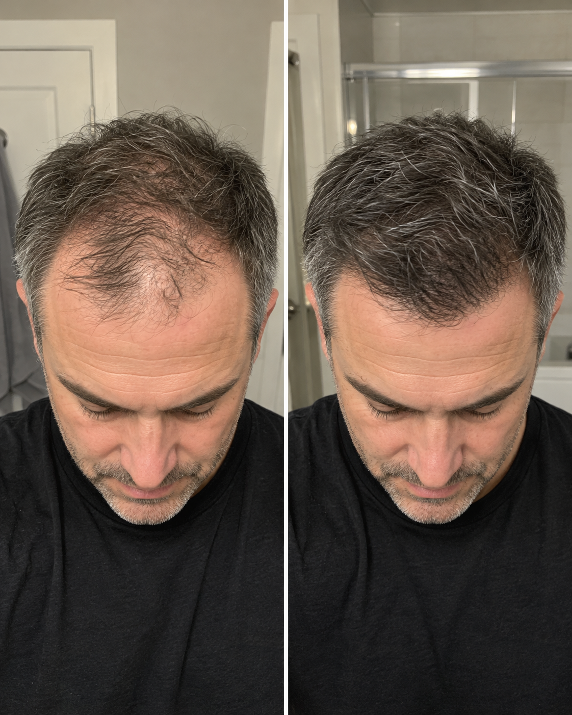 Hair care before and after result 1
