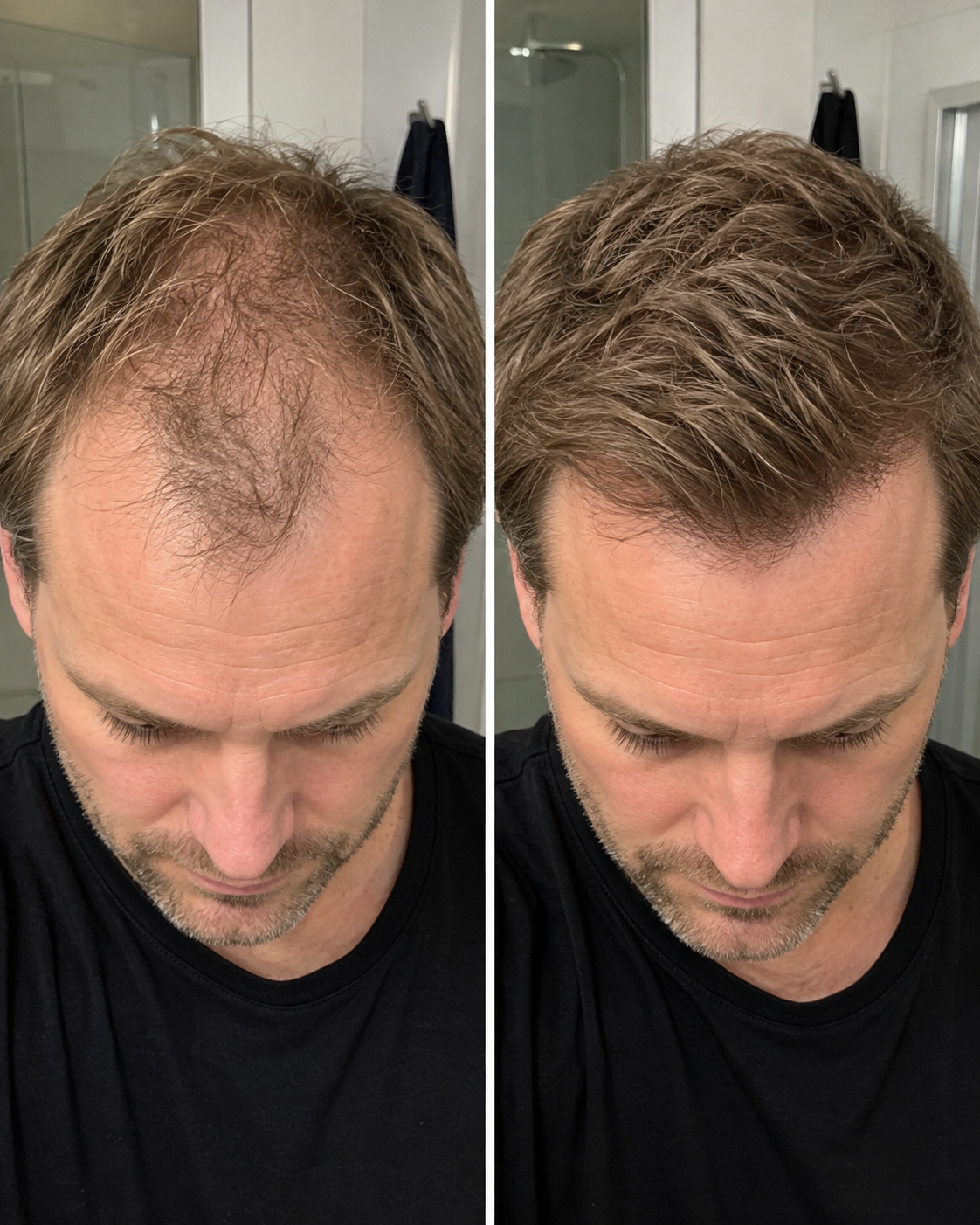 Hair care before and after result 6