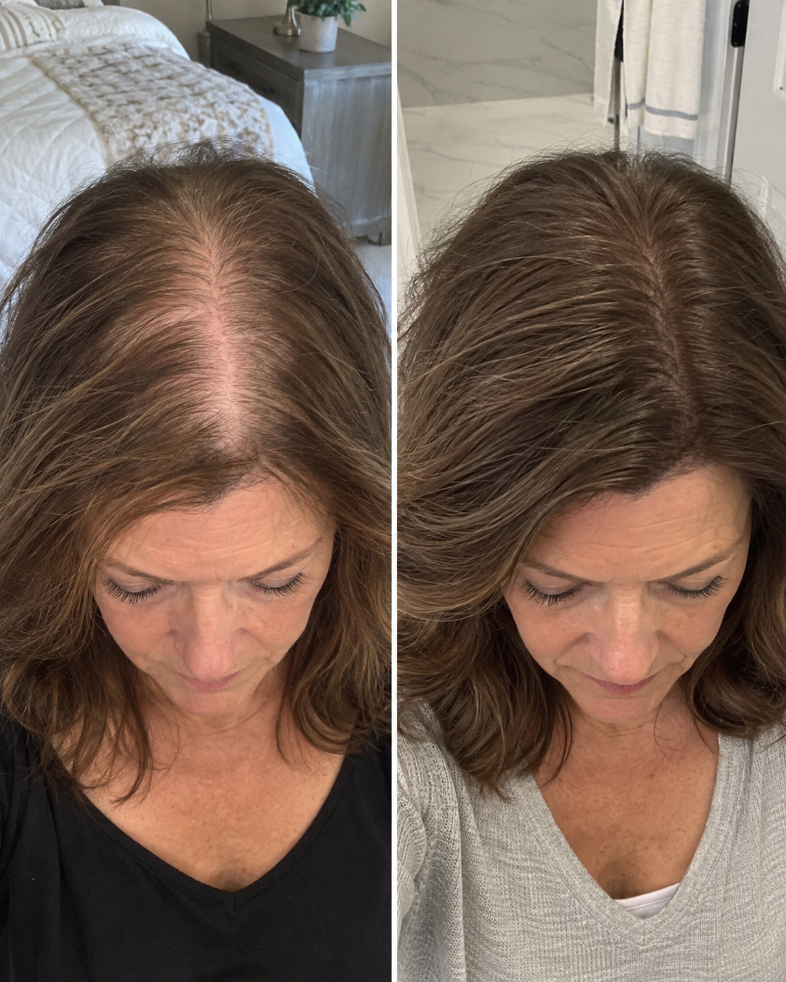 Hair care before and after result 7