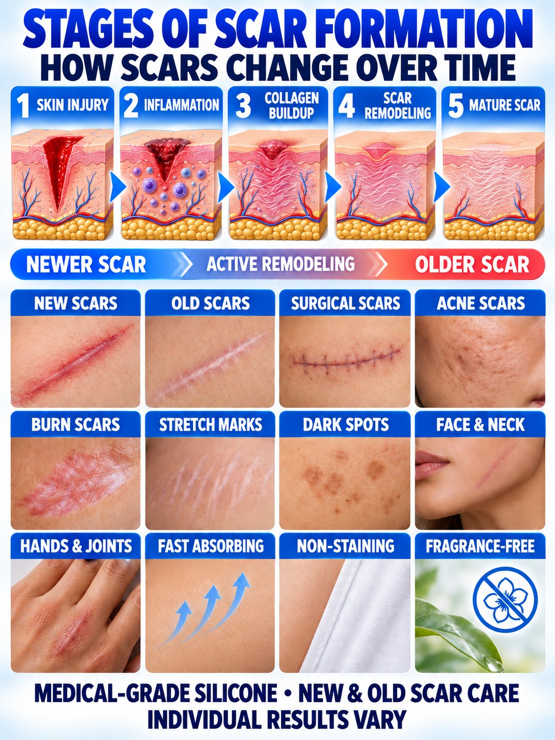 Stages of scar formation with examples of new, old, surgical, acne, burn and stretch-mark scars